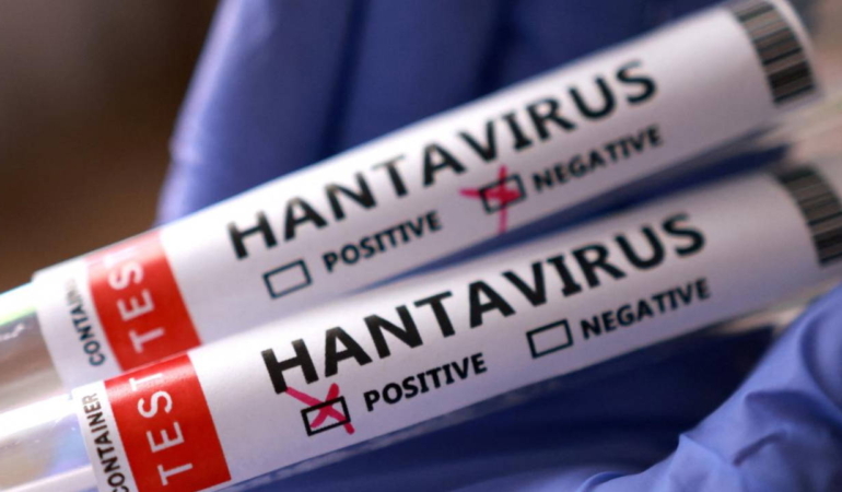 dunya-saglik-orgutu-baskanindan-hantavirus-mesaji-bu-yeni-bir-covid-19-degil-wX2rkOPn.jpg