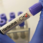 grip-ile-karistiriliyor-uzmanlardan-hantavirus-aciklamasi-rqplH3qG.jpg