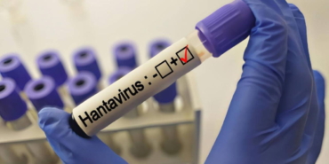 grip-ile-karistiriliyor-uzmanlardan-hantavirus-aciklamasi-rqplH3qG.jpg