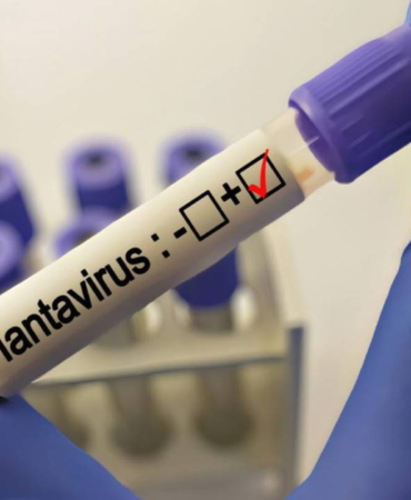 grip-ile-karistiriliyor-uzmanlardan-hantavirus-aciklamasi-rqplH3qG.jpg