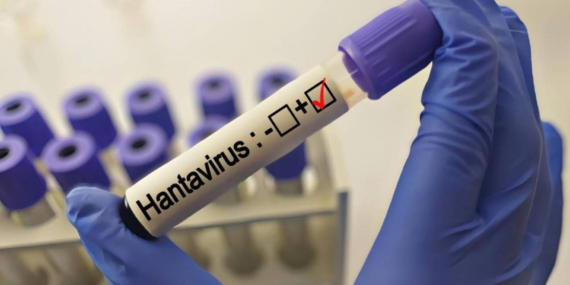 grip-ile-karistiriliyor-uzmanlardan-hantavirus-aciklamasi-rqplH3qG.jpg