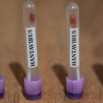 hantavirus-icin-abd-teyakkuzda-3-seviye-acil-durum-96XTPyl2.jpg