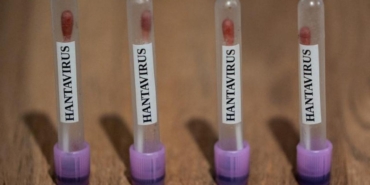 hantavirus-icin-abd-teyakkuzda-3-seviye-acil-durum-96XTPyl2.jpg