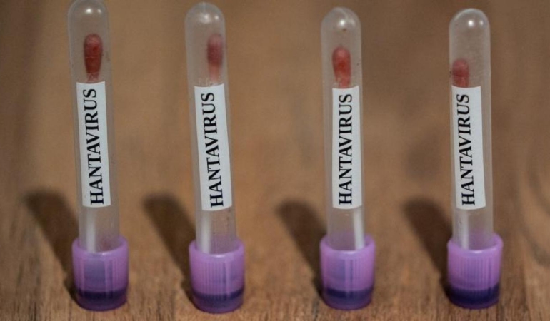 hantavirus-icin-abd-teyakkuzda-3-seviye-acil-durum-96XTPyl2.jpg