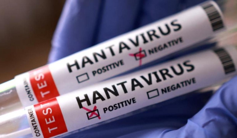 ingilterede-yeni-hantavirus-vakasi-gRcEJVlq.jpg